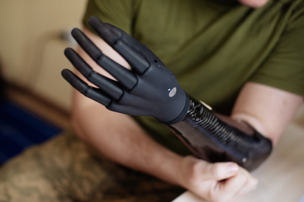 Esper Bionics Secures $5 million Investment Round for Bio-Prosthetics Production.